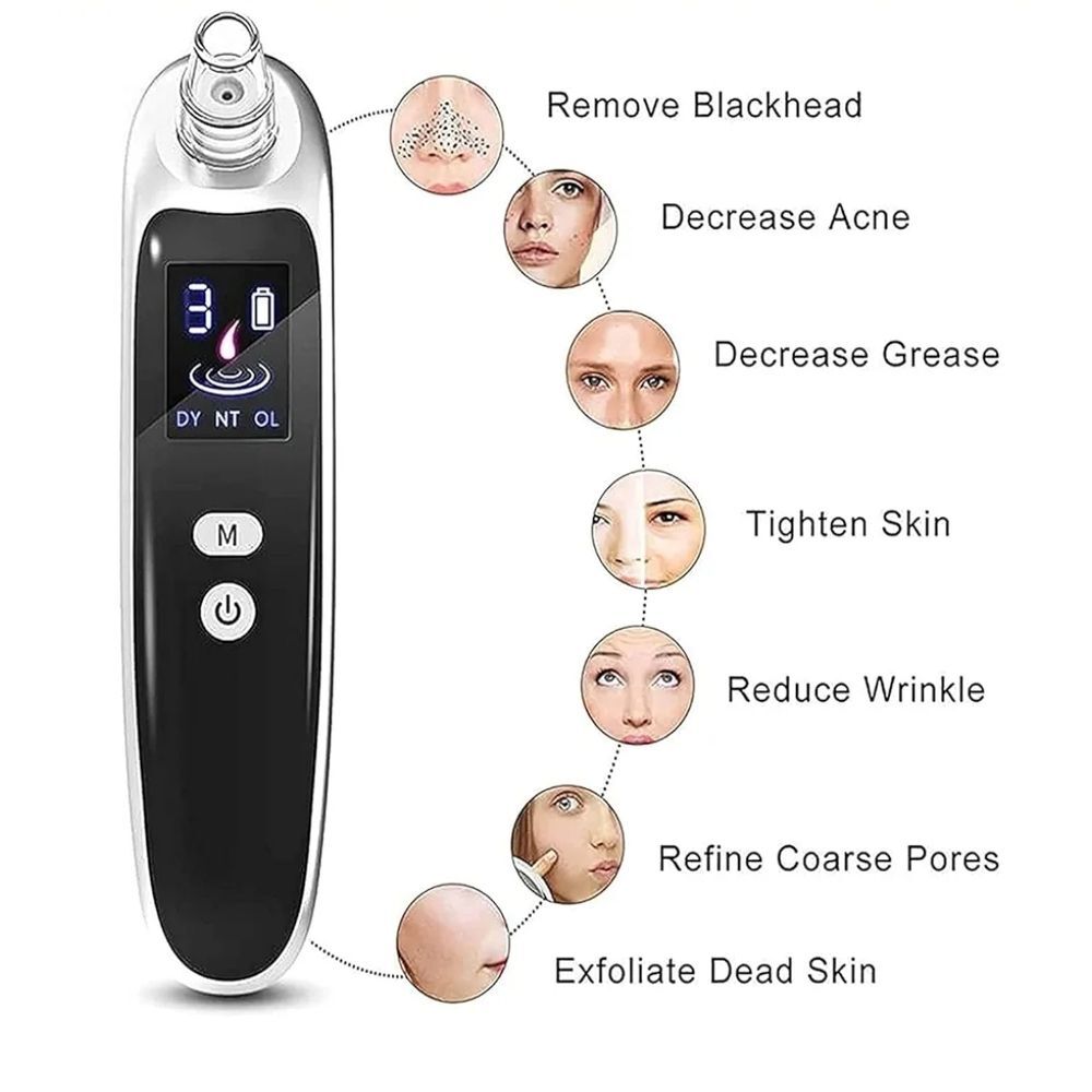 Advanced Blackhead Remover Vacuum - Black